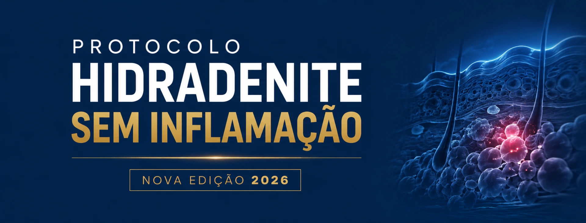 Protocolo Hidradenite Sem Inflamação — Nova Edição 2026